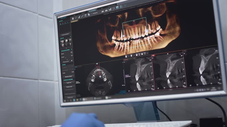 Full Mouth Reconstruction in Clarksville, AR